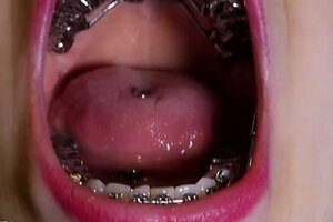 Braces Herbst &amp; Sandal Shoejob – Shoejobparadise